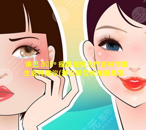 淋巴 🌺 痤疮如何治疗吉林市医生这样建议(淋巴部位长痤疮是怎么了)